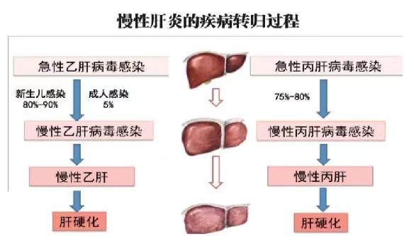 【健康科普】世界肝炎日——堅持早預(yù)防，加強(qiáng)檢測發(fā)現(xiàn)，規(guī)范抗病毒治療